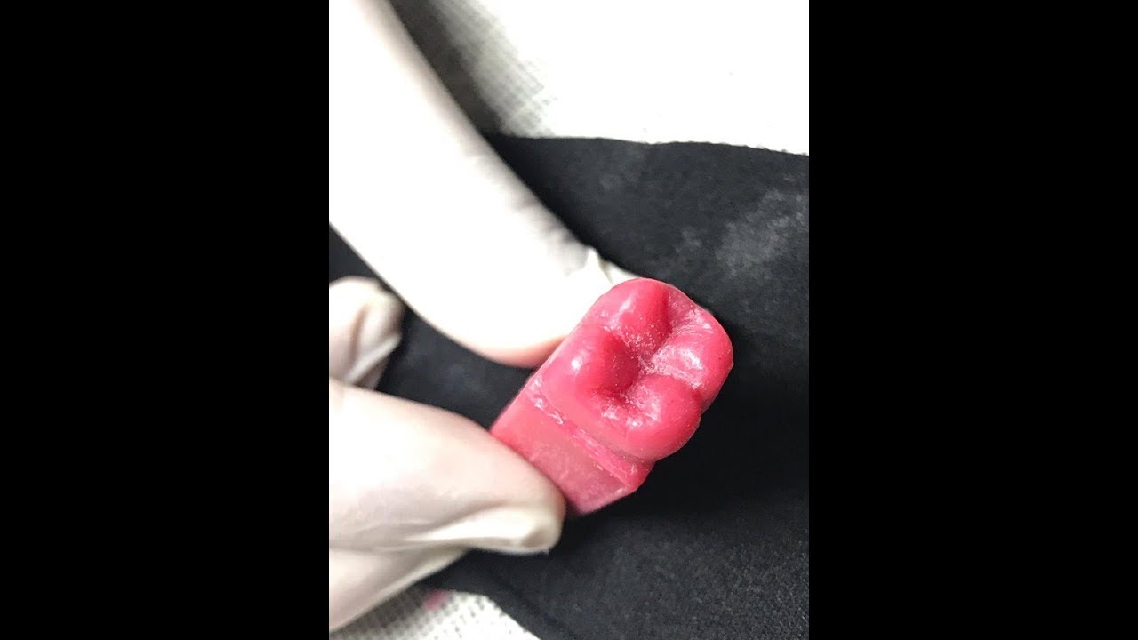 Lower second molar carving