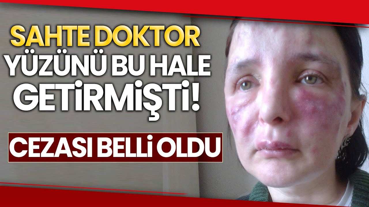 Yüzünde İşlem Yaptığı Kadını Tanınmaz Hale Getiren Sahte Doktor Hakkında Karar