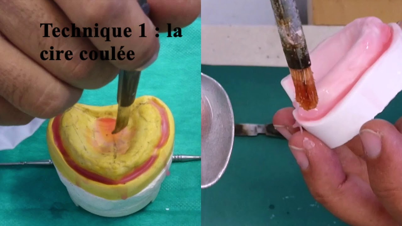 Réalisation d'une maquette de montage en cire