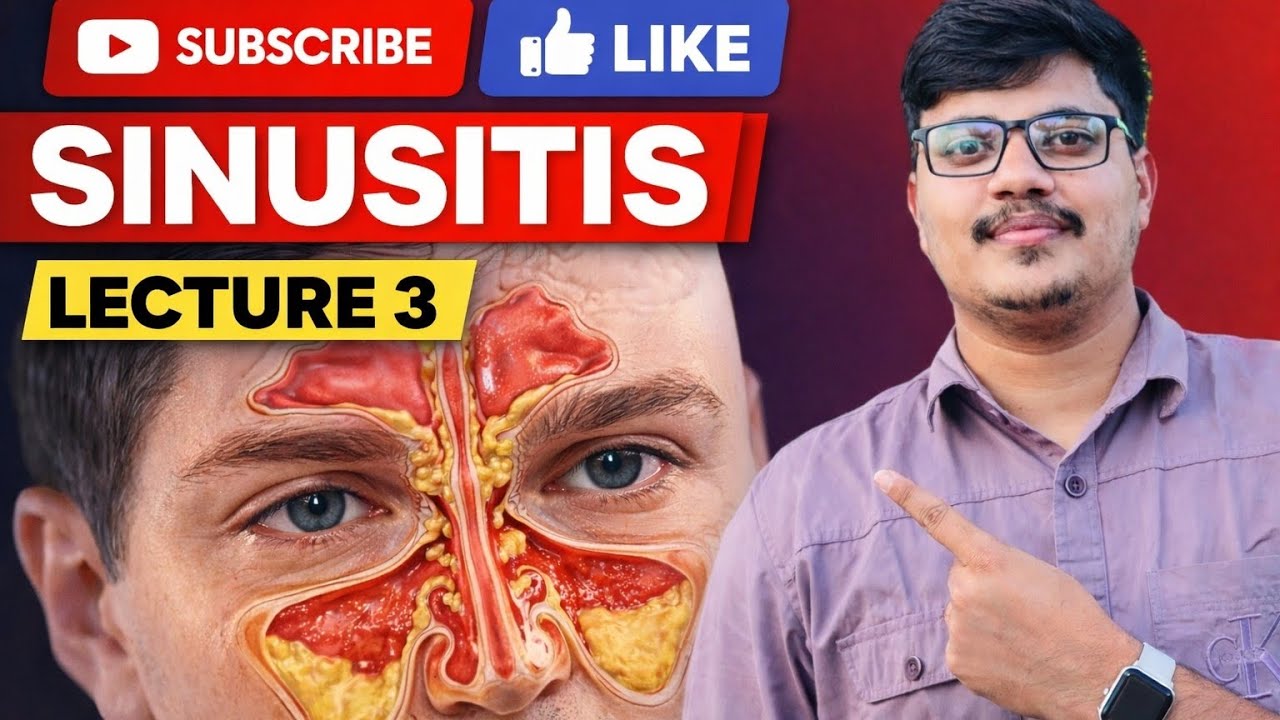 Sinusitis One Shot Lecture | Complete Concept for Nursing & Medical Students | Lecture 3