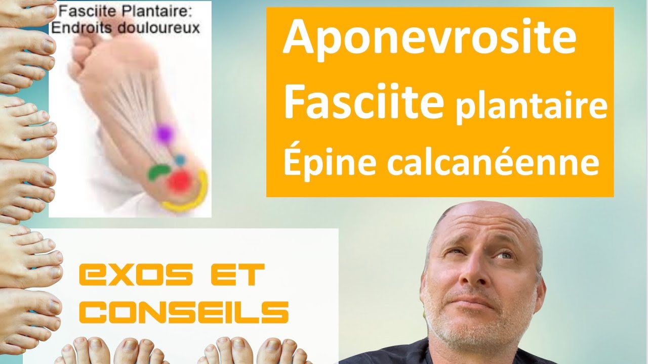 Fasciite plantaire, aponévrosite plantaire, épine calcanéenne