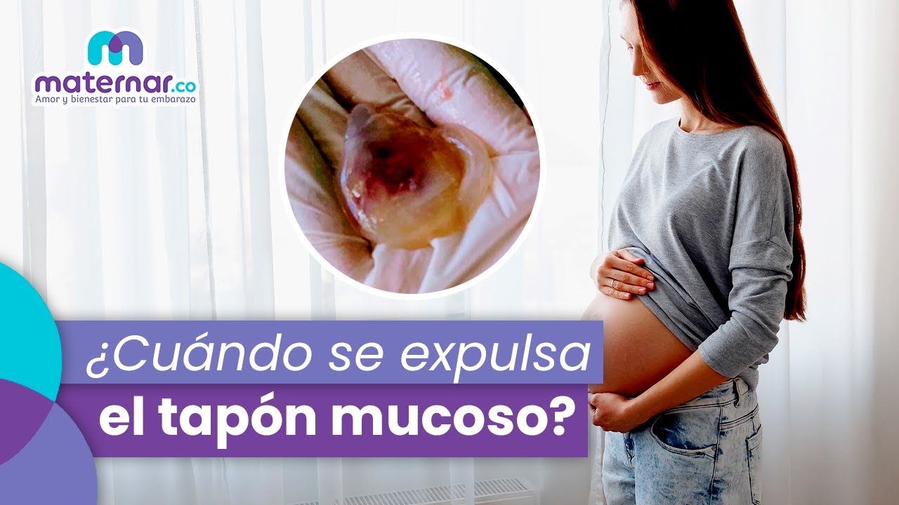 ¿El tapón mucoso es señal de parto?: 5 Preguntas frecuentes | Maternar.co