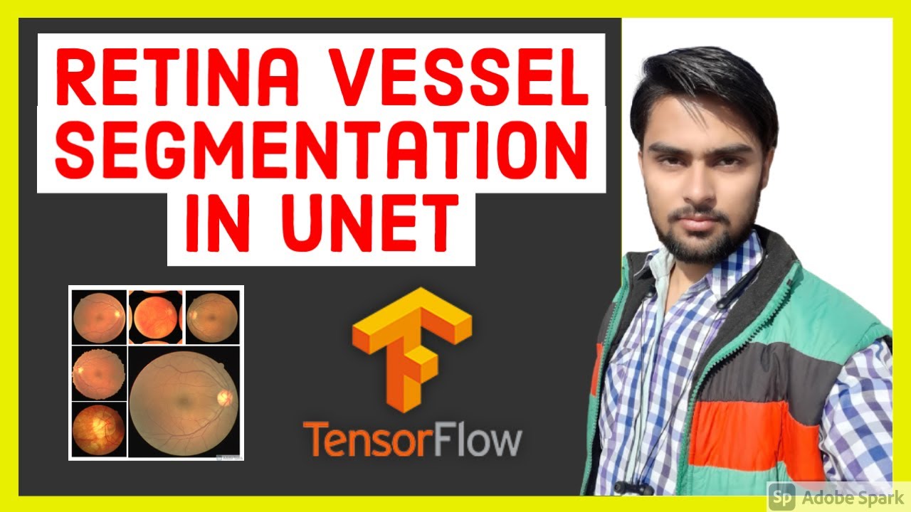 Retina Blood Vessel Segmentation using UNET in TensorFlow 2.0 (Keras) | Image Segmentation