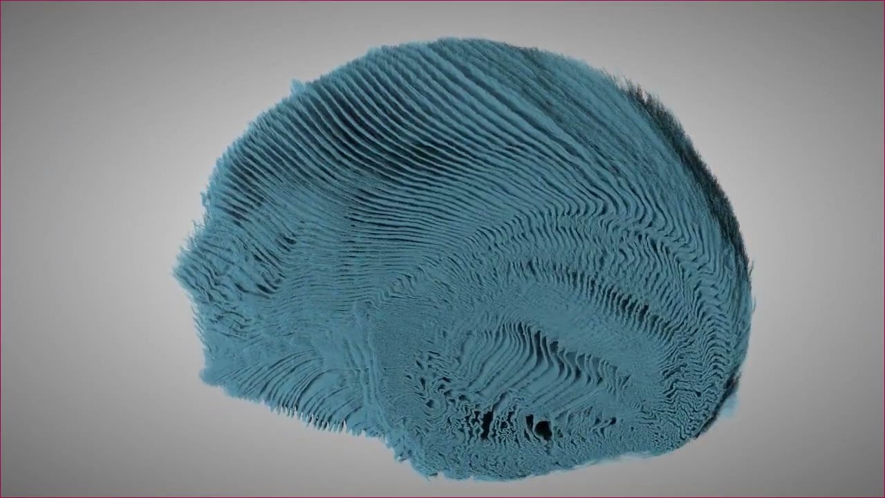 A strong quick-release biointerface in mussels