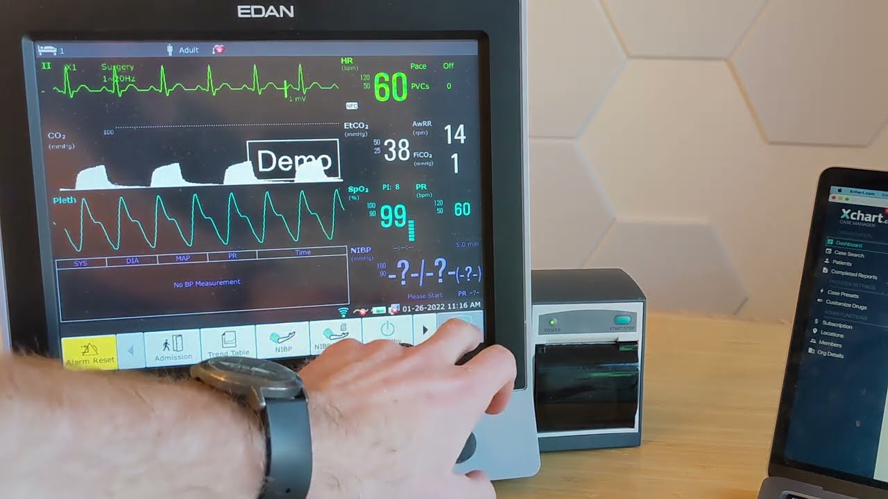 Connecting Edan X8 / Edan X10 / Edan X12 to your network for automatic vitals with Xchart.com