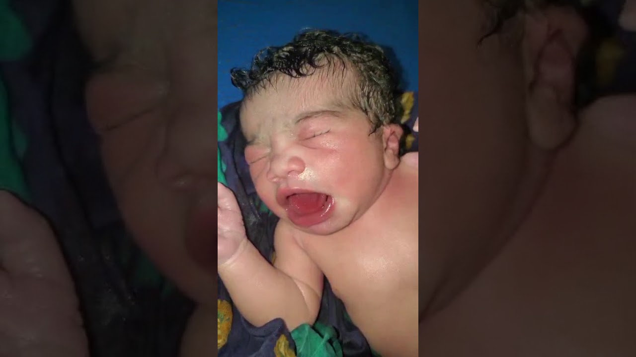 New Born Baby Normal Vernix Cleaning from Fresh Body