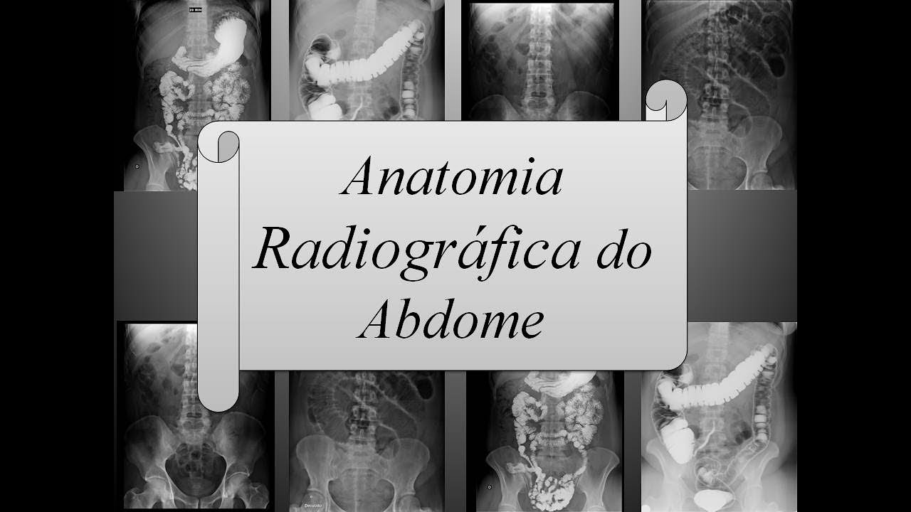 Anatomia Radiográfica do Abdome