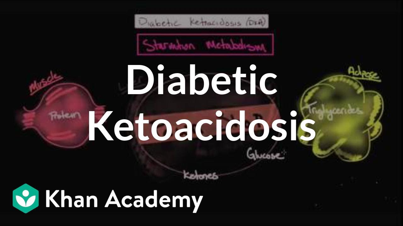 Acute complications of diabetes - Diabetic ketoacidosis | NCLEX-RN | Khan Academy