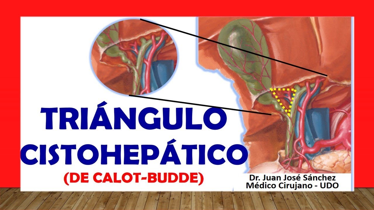 🥇 TRI&Aacute;NGULO DE CALOT. (CISTOHEP&Aacute;TICO). R&aacute;pido, F&aacute;cil y Sencillo.