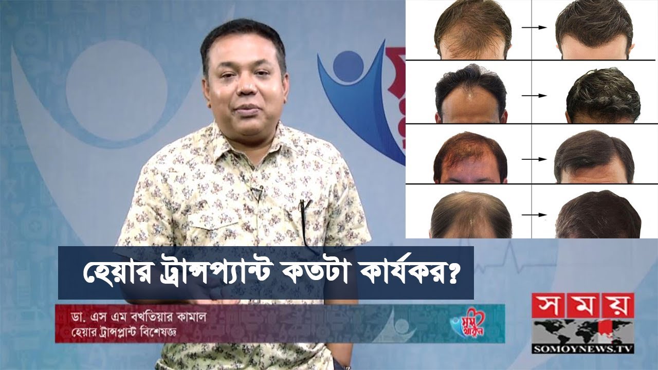 হেয়ার ট্রান্সপ্ল্যান্ট কতটা কার্যকর? | Hair Transplantation | Health Tips | Somoy TV