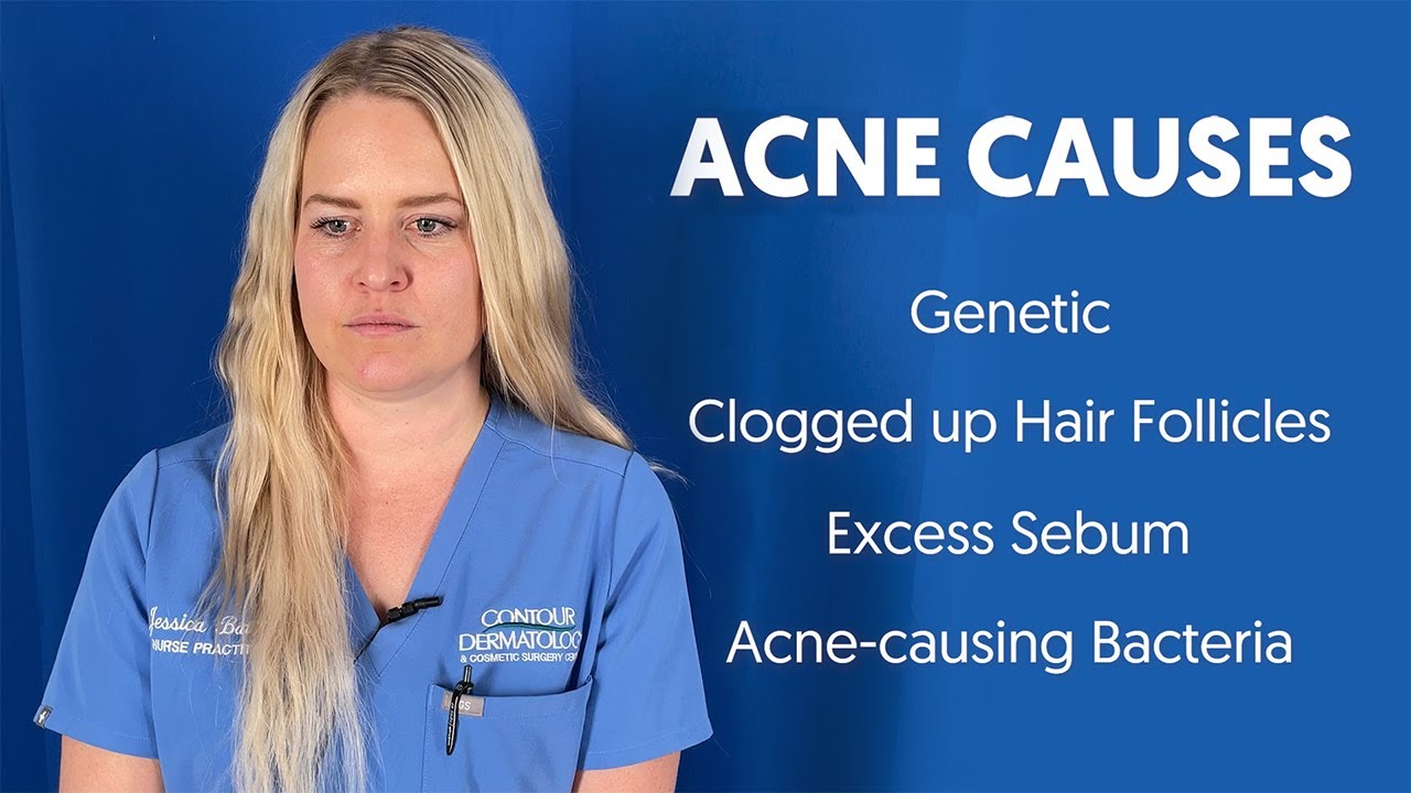 Understanding What Causes Acne