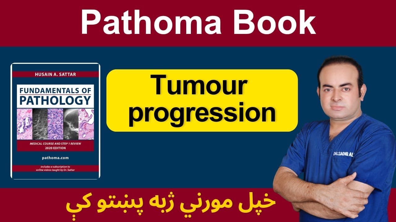 Tumour Progression | Dr. Sadiq Ali