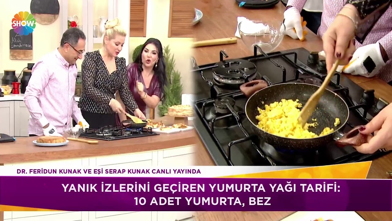 Yanık izlerini geçiren 