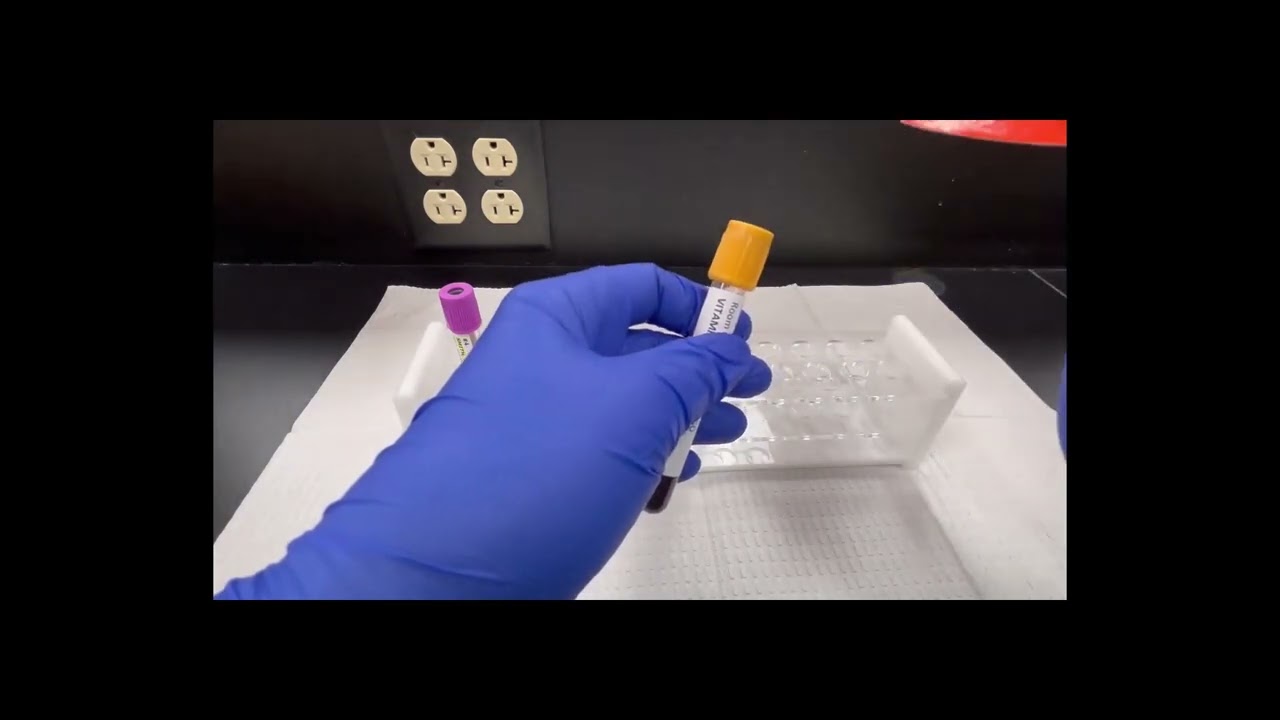 Aliquot Tubes and Specimen Processing