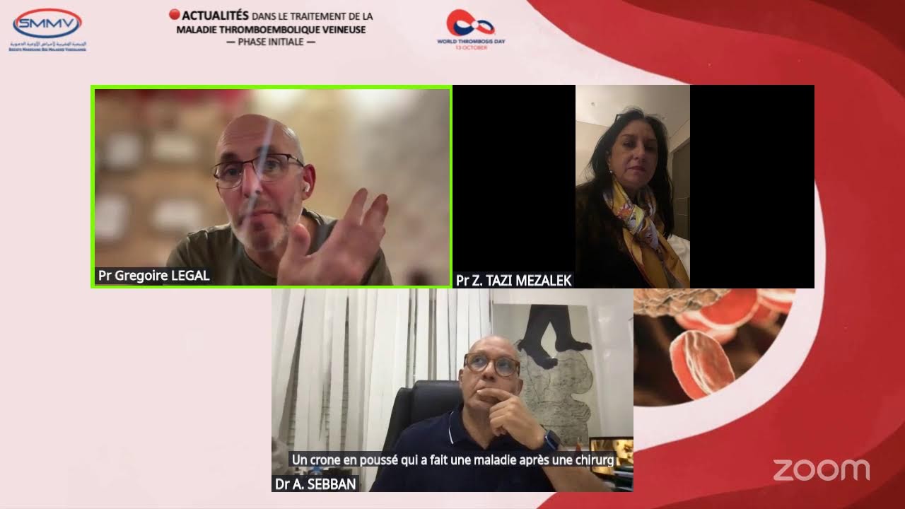 SMMV: Actualités dans le traitement de la maladie thromboembolique veineuse à la phase initiale.