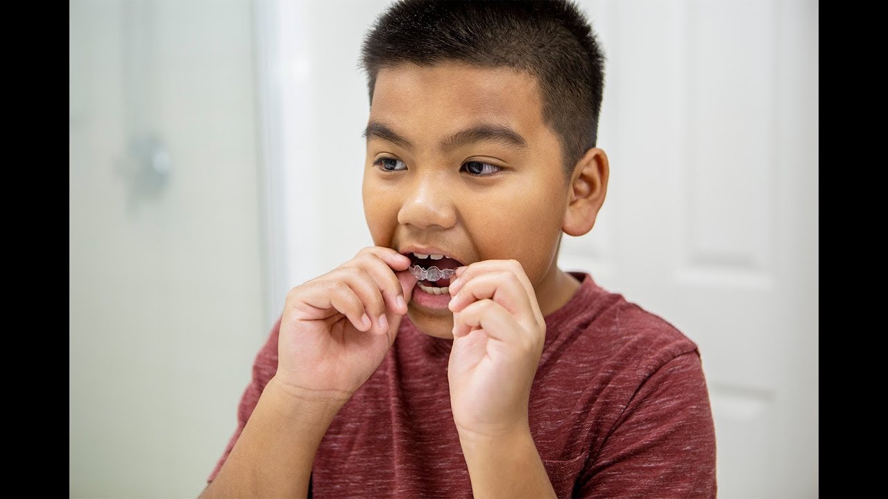 Our 9- and 10-Year Old’s Experiences Transitioning into Invisalign® First Aligners