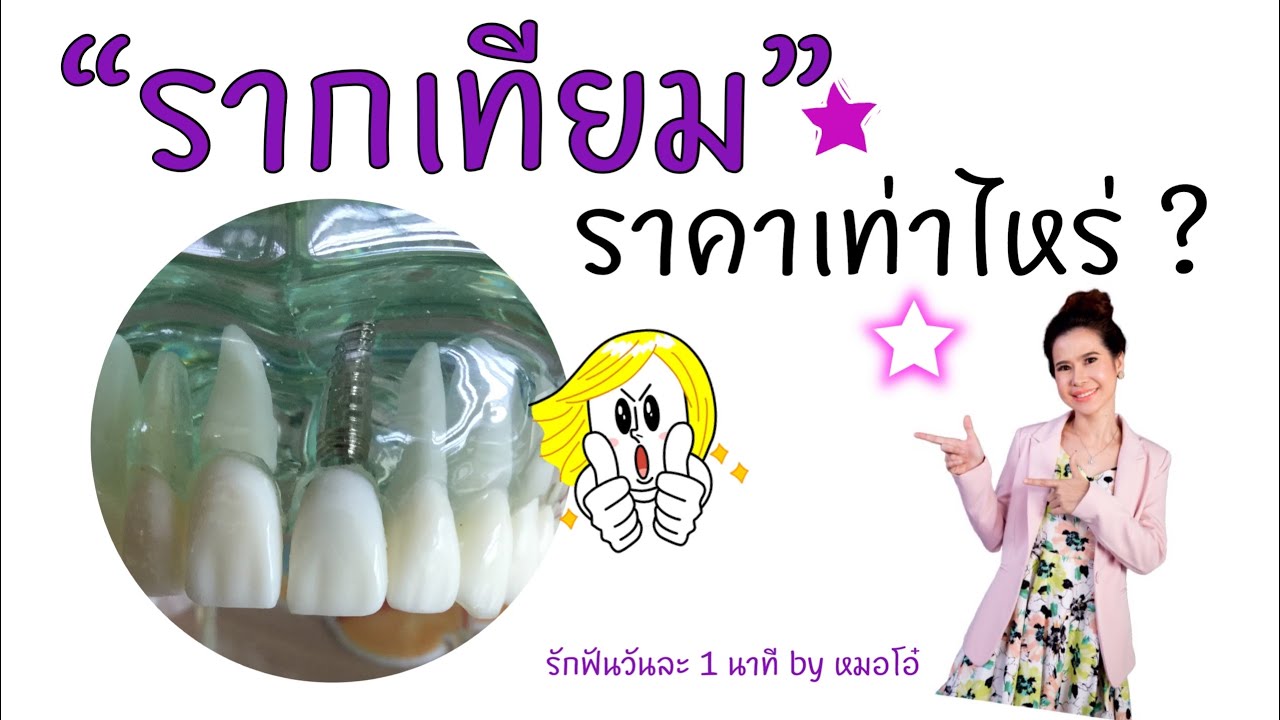ขั้นตอน และ ค่าใช้จ่าย รากเทียม ฟันปลอมติดแน่น แบบไม่ต้องถอดล้าง /รักฟันวันละ1นาทีbyหมอโอ๋