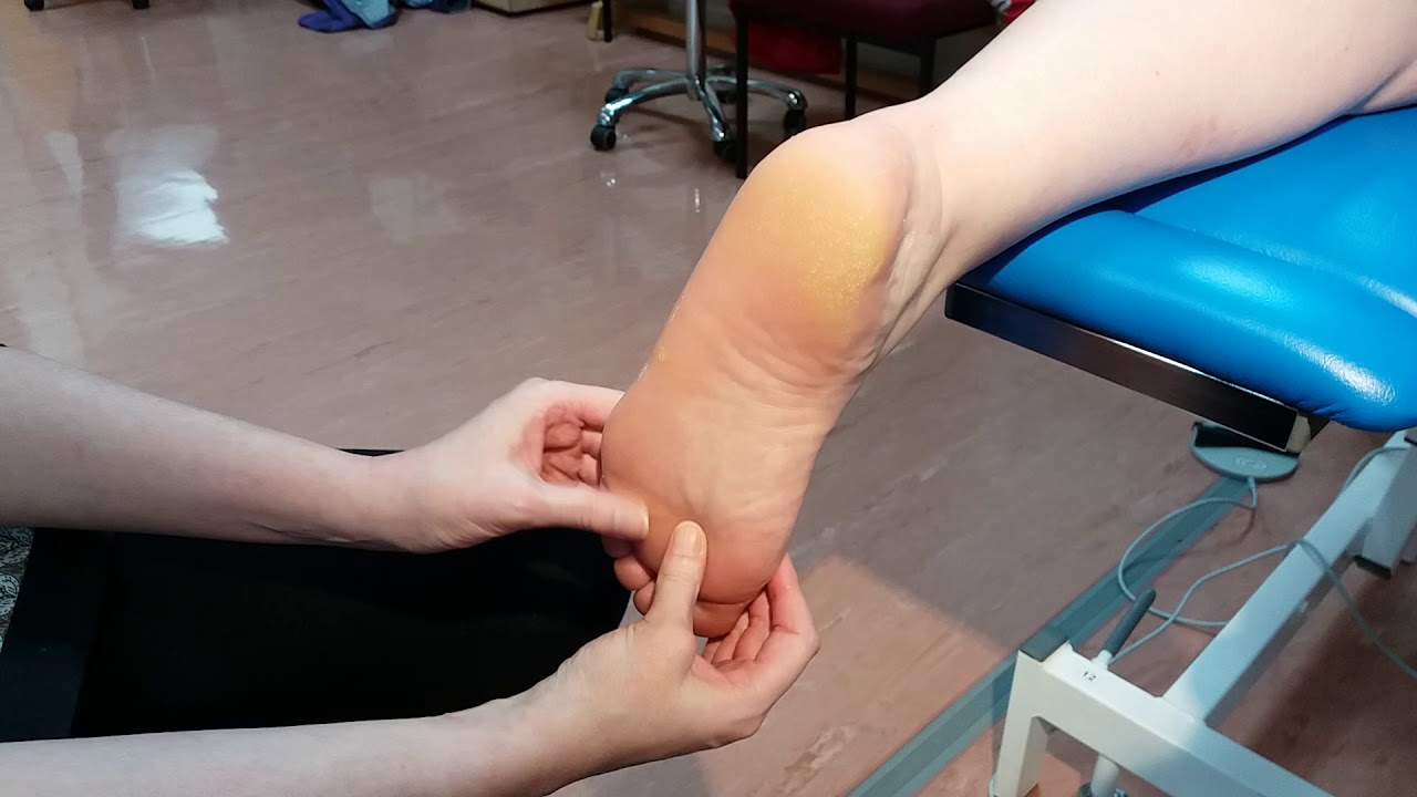 Plantar fat pad palpation
