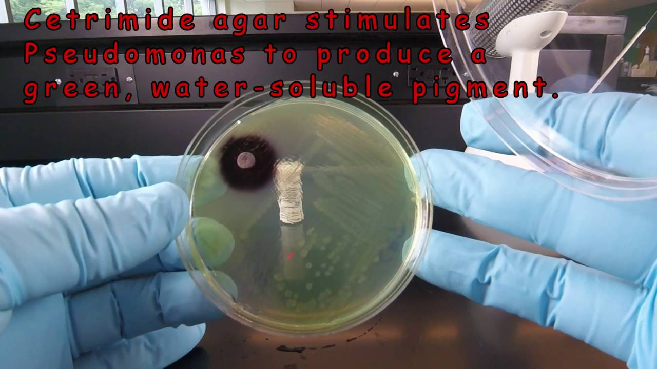 Using the Oxidase Test and Cetrimide Agar to Identify Pseudomonas