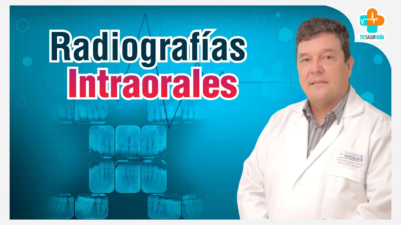 Radiografías Intraorales | Tu Salud Guía