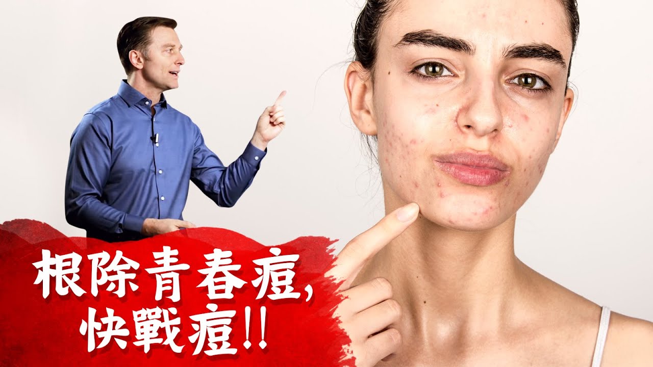 快速根除青春痘!!粉刺痘痘的原因？缺營養？柏格醫生