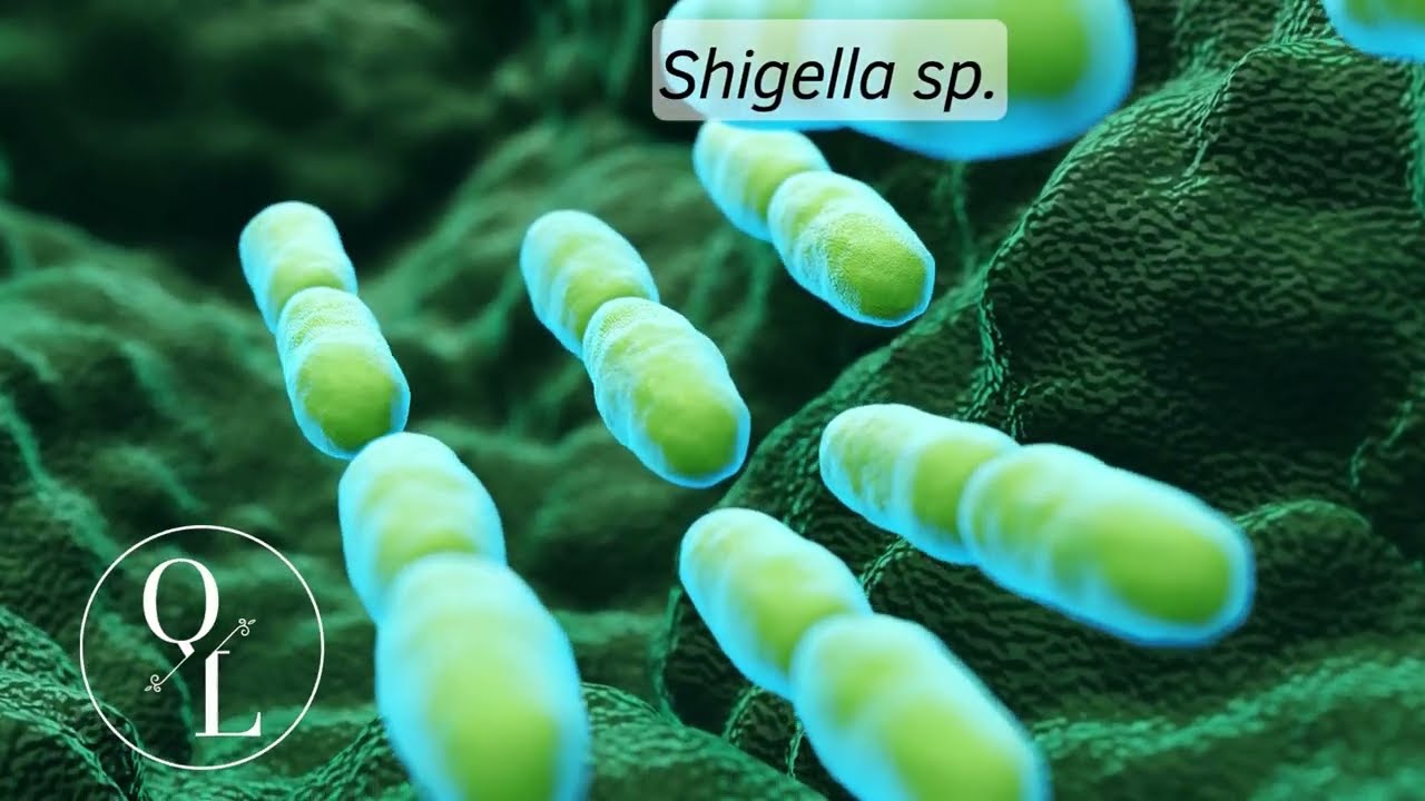 16. Shigella sp