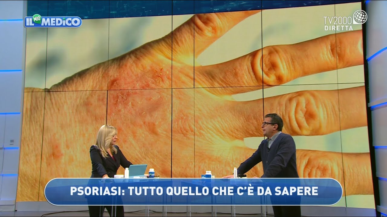 Psoriasi: le ultime cure