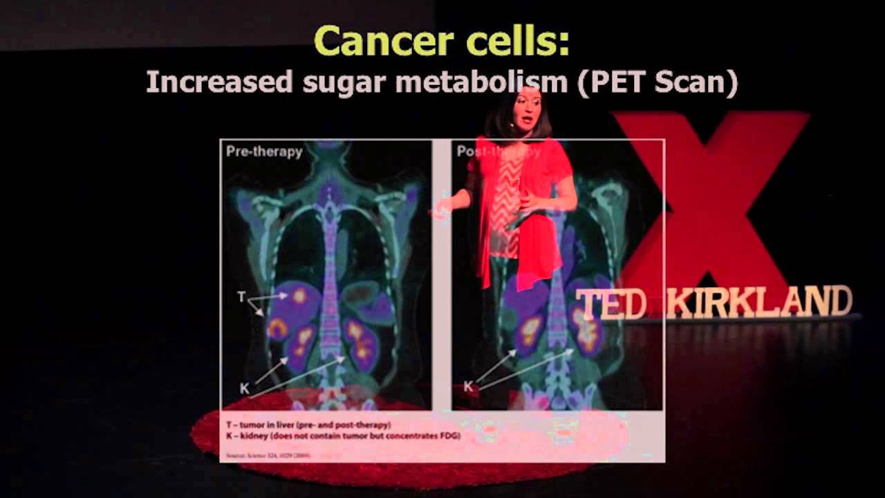 The future of viral therapy | Tracie Delgado | TEDxKirkland