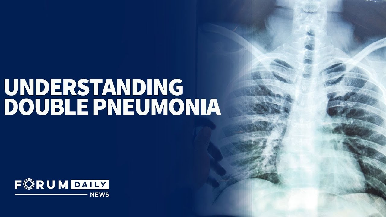 Understanding Double Pneumonia