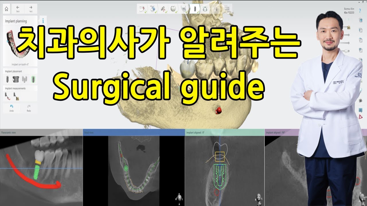 치과의사가 알려주는 서지컬 가이드