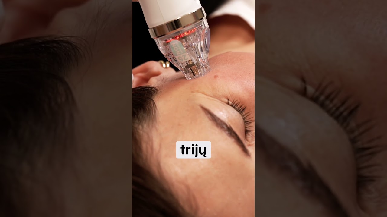 Kiek Secret RF procedūrų rekomenduojama atlikti? #skincare  #secretRF #rauksles #oda