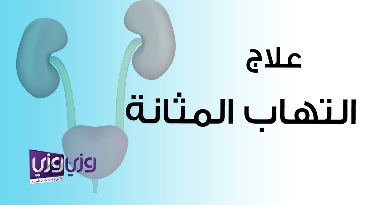 علاج التهاب المثانة