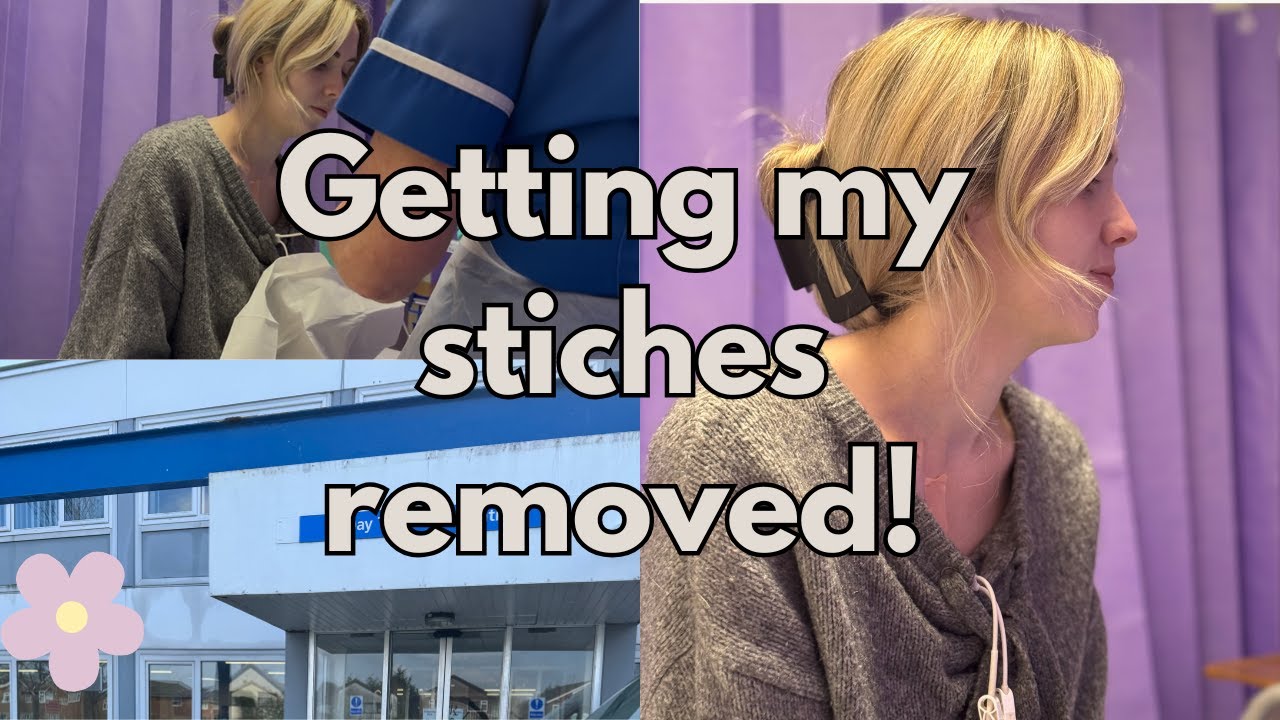 Getting my stitches removed | I have a problem with my Hickman Line |