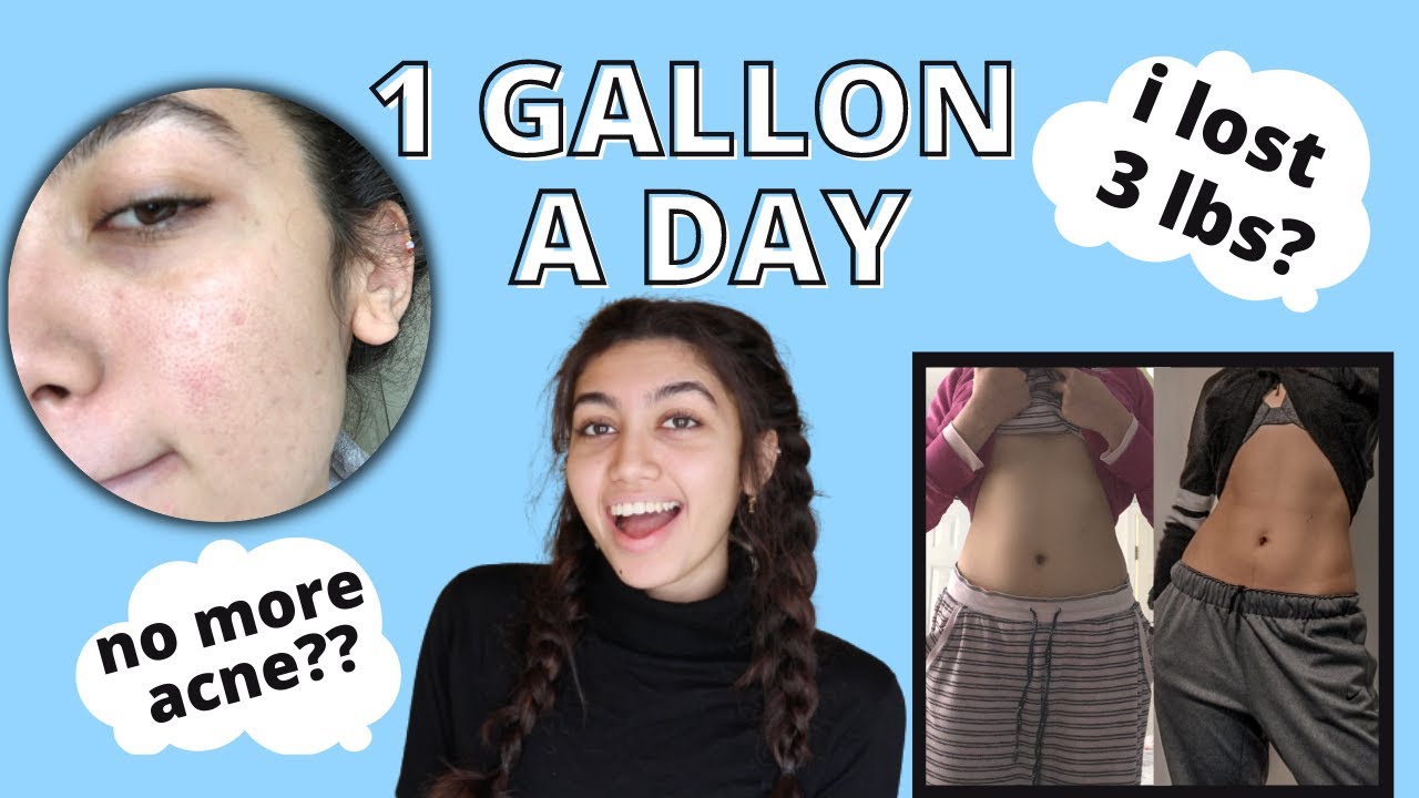 I drank a GALLON of WATER Everyday for a Week... & here's what happened