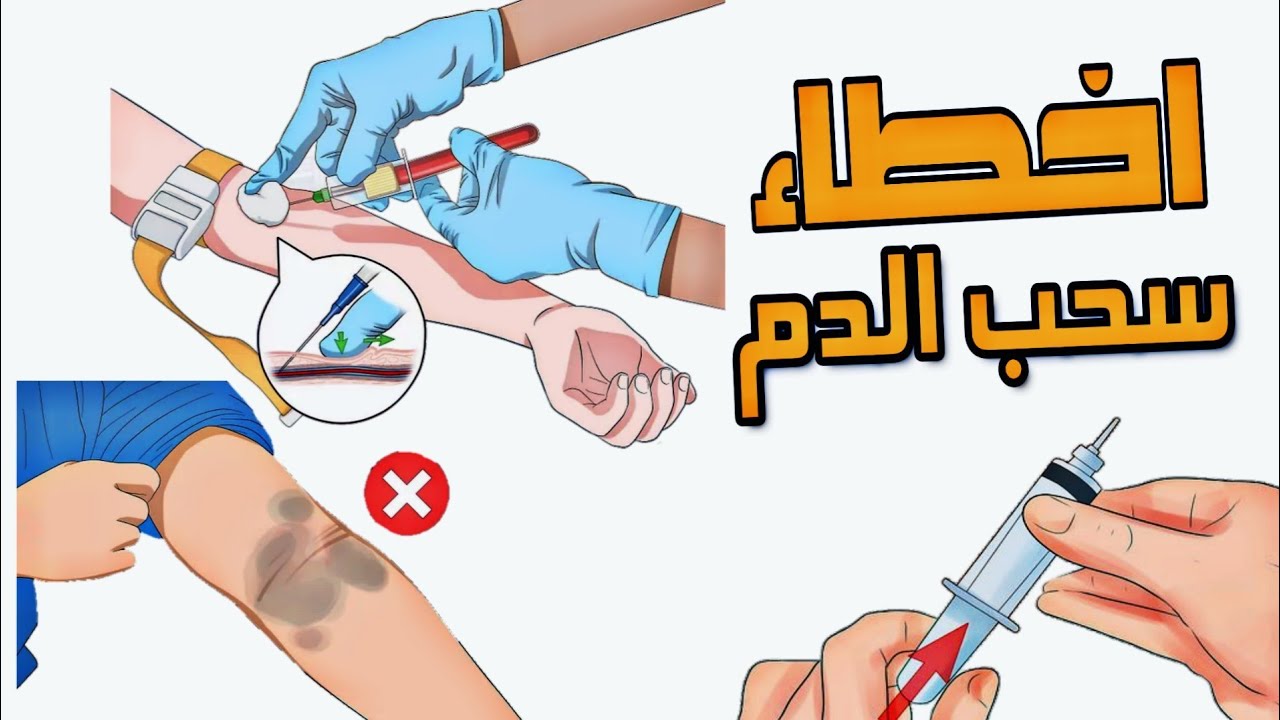 أخطاء سحب الدم الوريدي