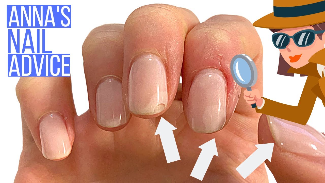 10 Reasons Why Shellac Chips & Peels. [ANNA'S NAIL ADVICE]