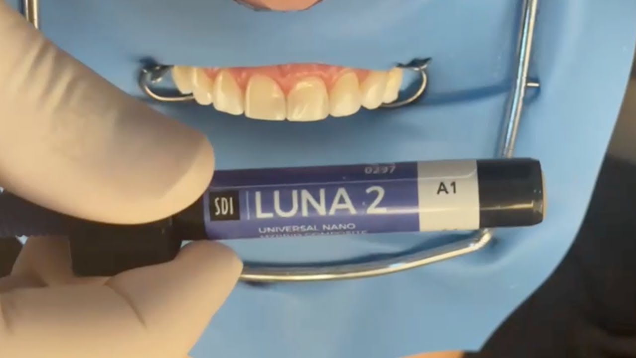 Utilização clínica da Resina Luna 2 e Luna Flow | Prof. Renato Voss Rosa