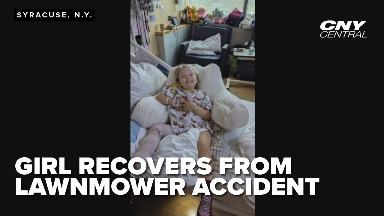 Hospital staff saves little girl after scary lawnmower accident
