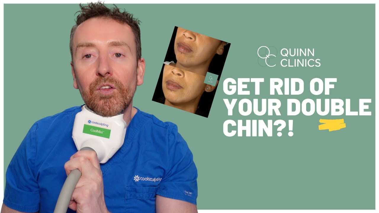 Double Chin | How To Get Rid Of A Double Chin | 3 BESPOKE Solutions For YOU