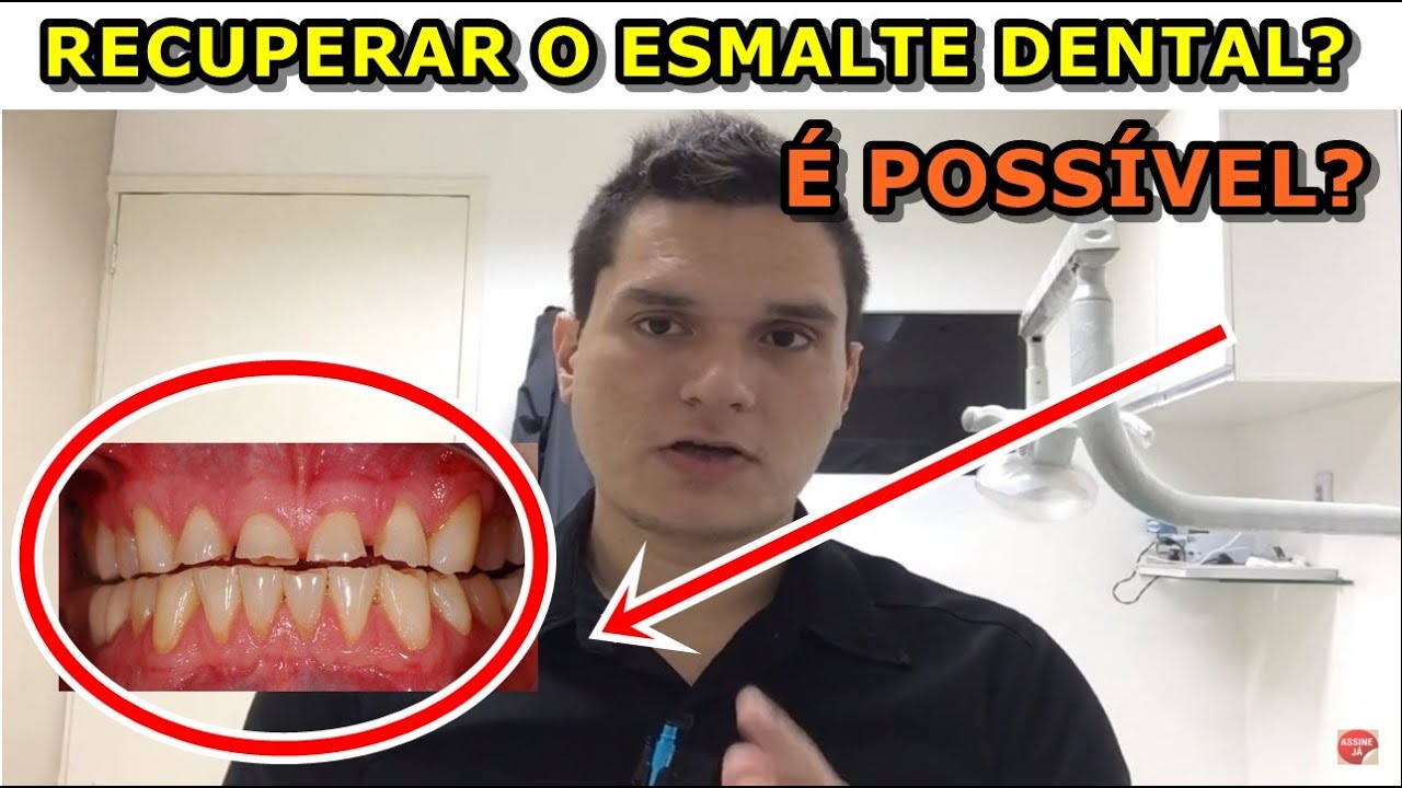 &Eacute; poss&iacute;vel recuperar o esmalte dental? A verdade revelada.