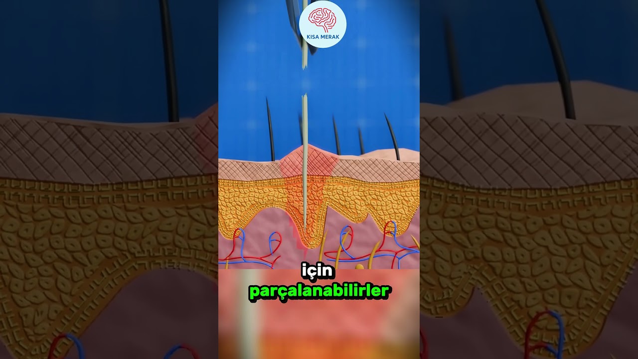 Kakt&uuml;s dikenleri nasıl g&uuml;venle &ccedil;ıkarılır 🌵🧴🩹