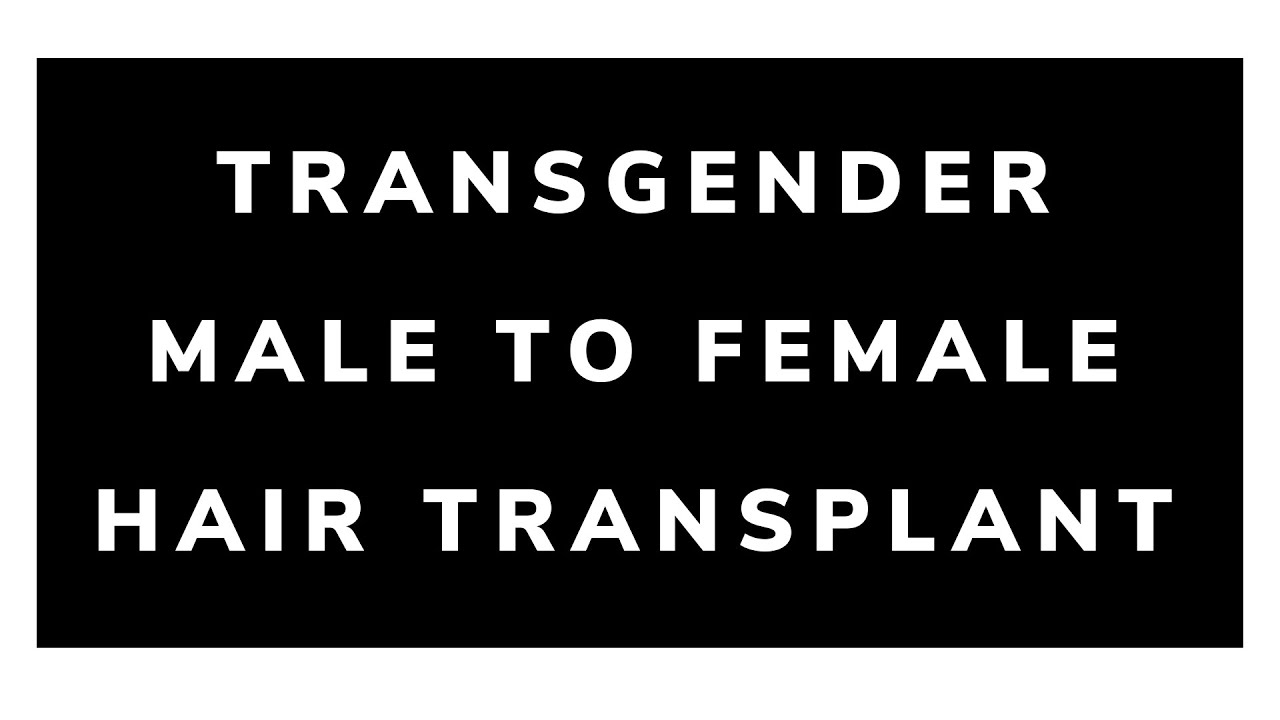 Transgender Male to Female Hair Transplant Q and A