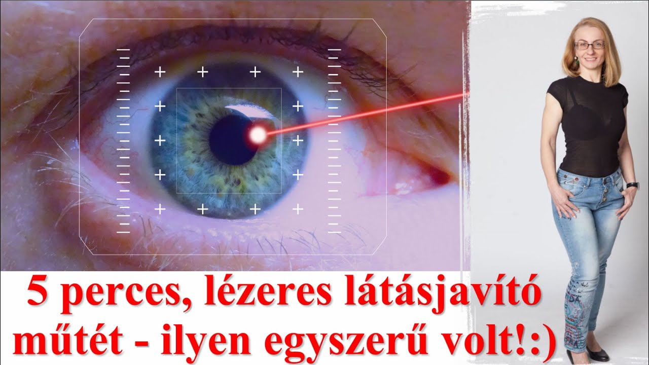 Műlencse-beültetés utáni lézeres korrekció élőben - LASIK 5 percben