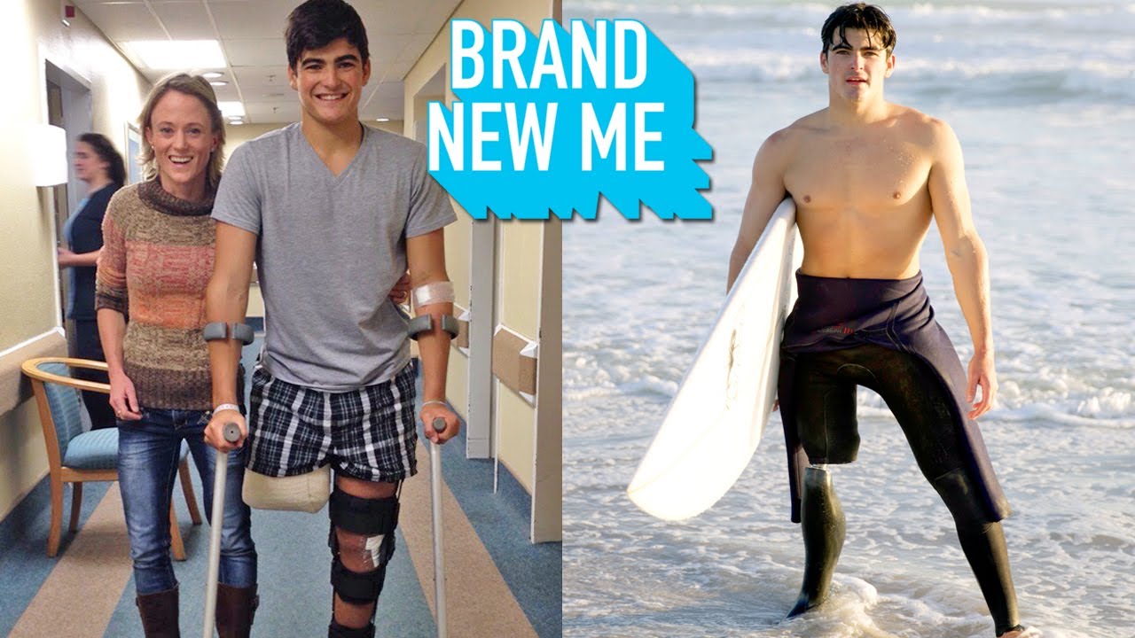 A Shark Bit My Leg Off - So I Took Up Surfing | BRAND NEW ME