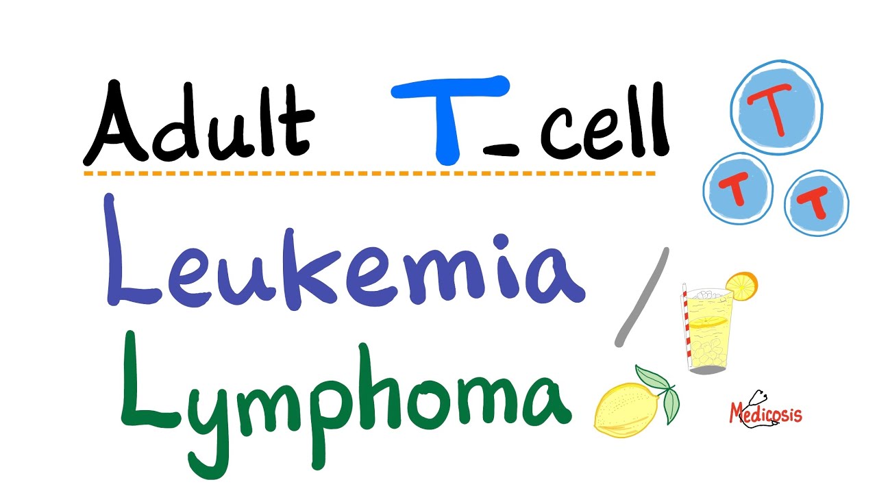 Adult T- cell Leukemia / Lymphoma - Human T-cell Leukemia Virus (HTLV-1) - Oncology