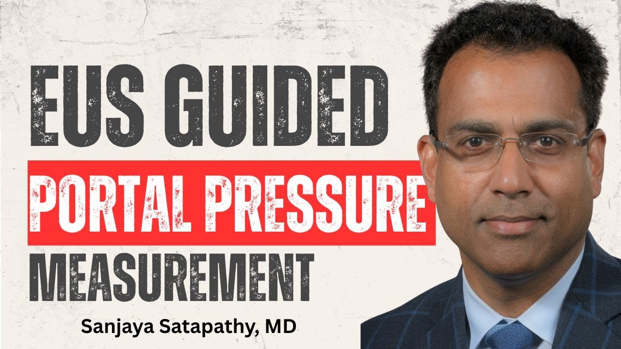Endoscopic Ultrasound (EUS) - Guided Portal Pressure Measurement by Prof. Sanjaya Satapathy, MD