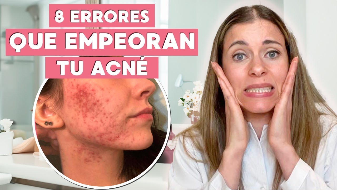 😰ESTO ESTÁ EMPEORANDO TU ACNÉ⚠️ no hagas esto con tu piel!