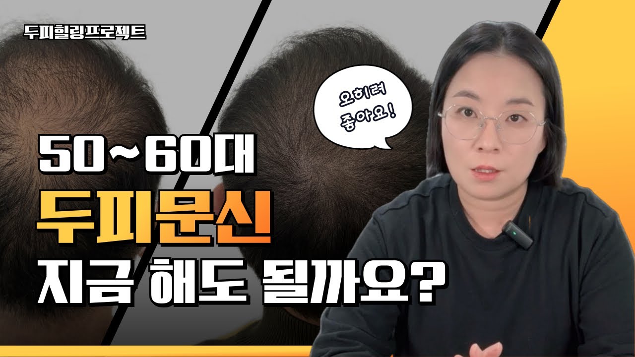 50–60대, 두피문신 해도 늦지 않았을까요?