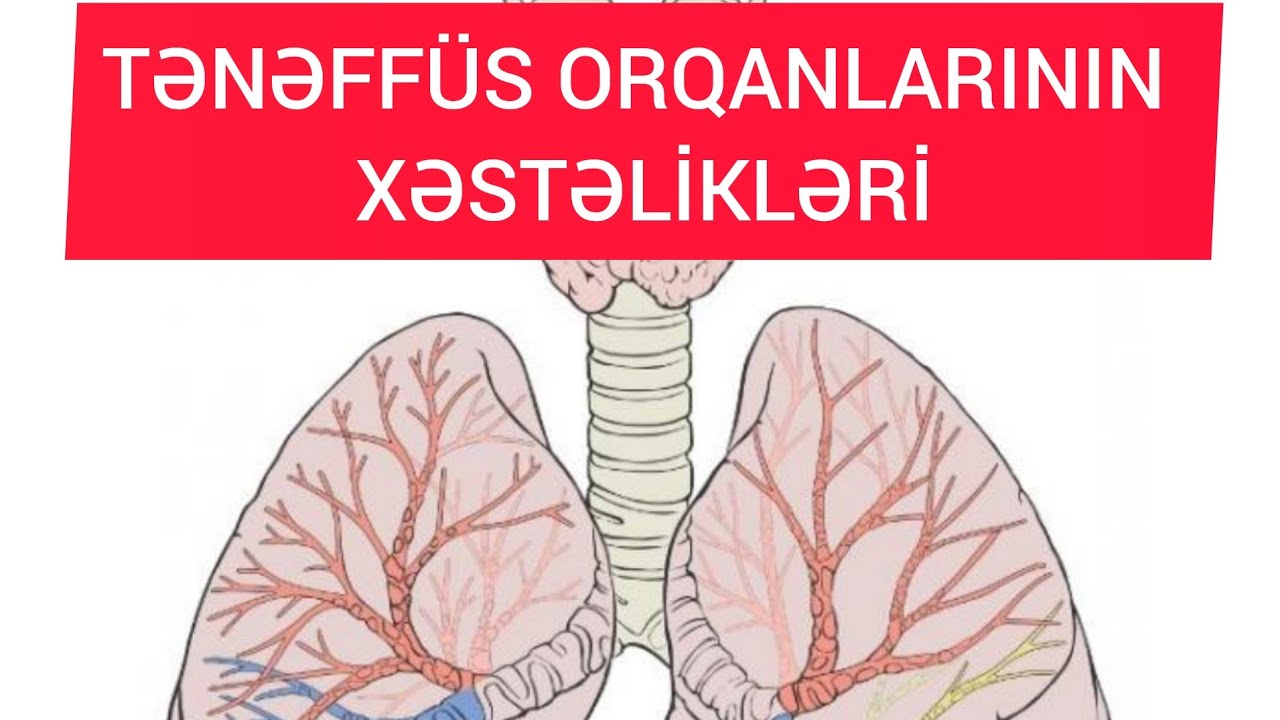 TƏNƏFFÜS ORQANLARININ XƏSTƏLİKLƏRİ. (Ağciyərlərin iltihabı ,Bronxial astma, Astma ,Plevritlər)