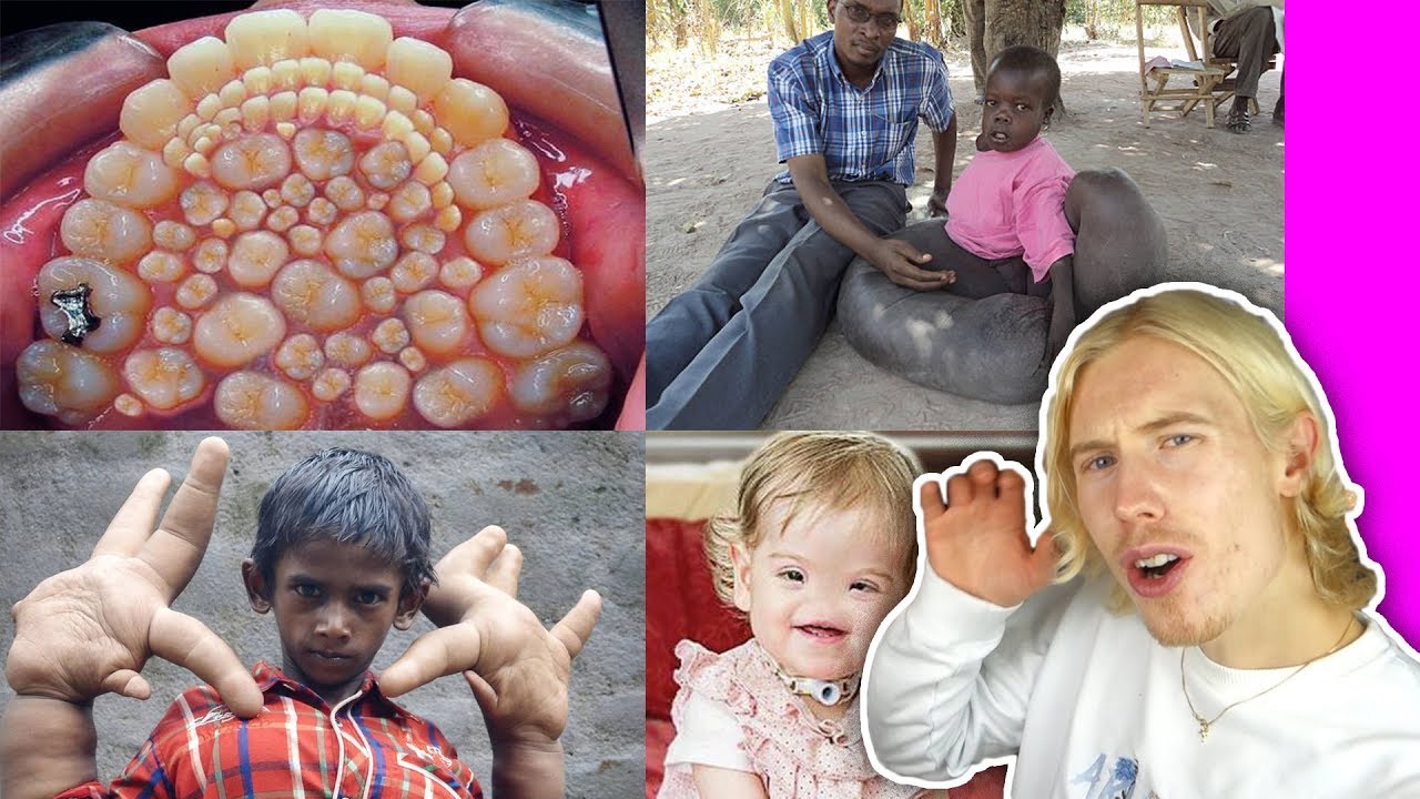 10 barn med OVANLIGA sjukdomar du inte trodde fanns